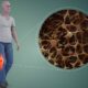 Osteoporosis: Gejala, Penyebab, dan Cara Pengobatan